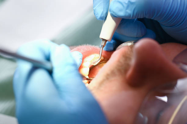 Best Emergency Treatment for Oral Infections in , MD