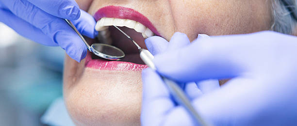 Best Knocked-Out Tooth (Avulsed Tooth) Treatment in , MD